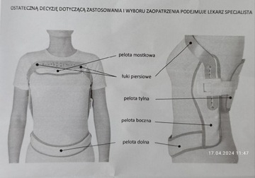 QMED HX-3 Gorset ortopedyczny typu Jewetta "M"