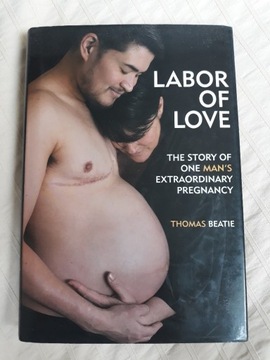 Labor of love. Thomas Beatie