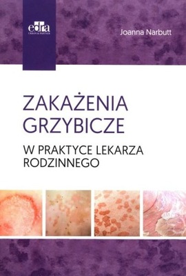 Zakażenia grzybicze w praktyce lekarza rodzinnego