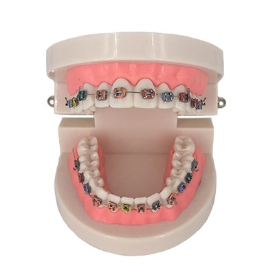 Model ortodontyczny zębów