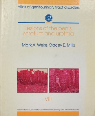 Atlas of genitourinary tract disorders Section 8 Lesions of the penis, scro