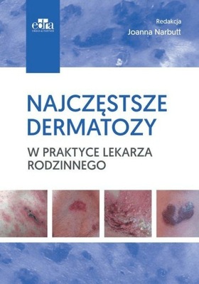 Najczęstsze dermatozy w praktyce lekarza...