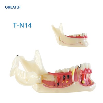 Model zębów dentystycznych Model nauczania zębów