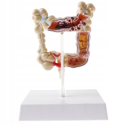 Anatomiczna 1:2 patologiczny ludzki model