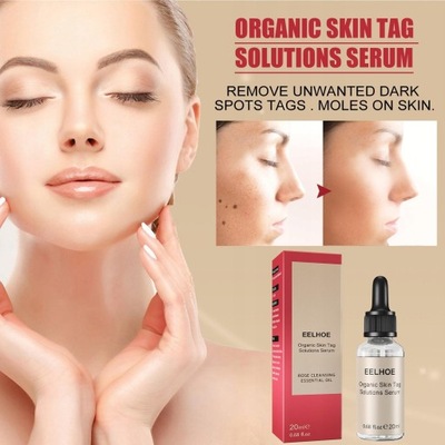 20ml Organic Skin Tag Solutions Serum Essence Oil