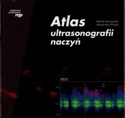 Atlas ultrasonografii naczyń - Marek Krzanowski