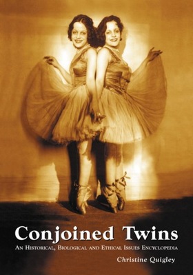 Conjoined Twins - Christine Quigley