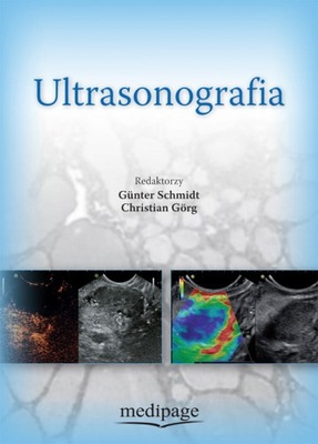 ULTRASONOGRAFIA