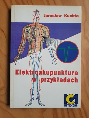 Elektroakupunktura w przykładach , KUCHTA