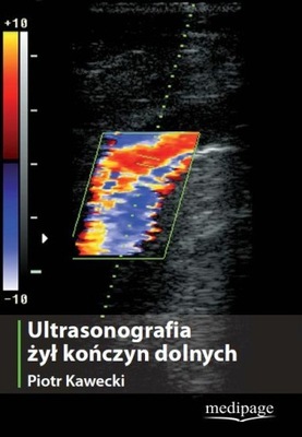 ULTRASONOGRAFIA ŻYŁ KOŃCZYN DOLNYCH. KAWECKI