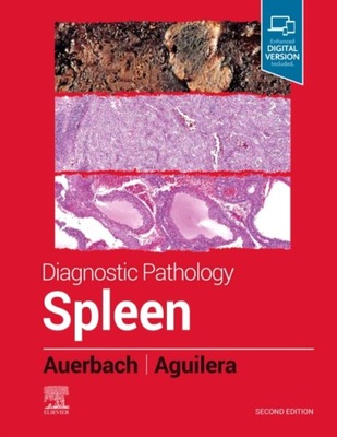 Diagnostic Pathology: Spleen AARON (SENIOR HEMATOPATHOLOGIST AUERBACH