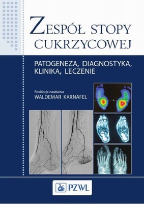 Zespół stopy cukrzycowej Patogeneza, diagnostyka,