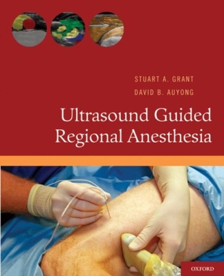 Ultrasound Guided Regional Anesthesia EBOOK