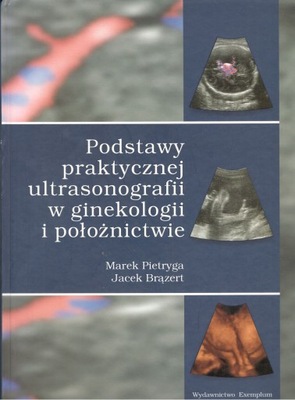 Podstawy praktycznej ultrasonografii w ginekologii i położnictwie .