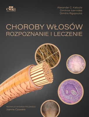 Choroby włosów. Rozpoznanie i leczenie D Rigopoulos