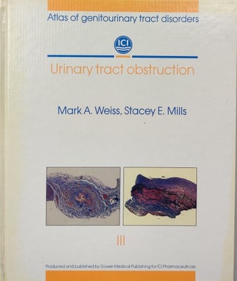 Atlas of genitourinary tract disorders Section 3 Urinary tract obstruction