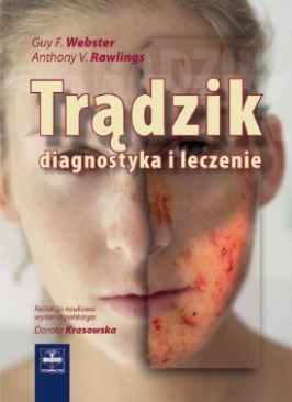 TRĄDZIK DIAGNOSTYKA I LECZENIE