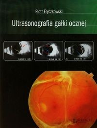 ULTRASONOGRAFIA GAŁKI OCZNEJ PIOTR FRYCZKOWSKI