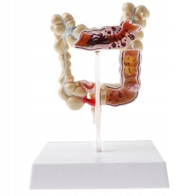 anatomiczna 1:2 patologiczny ludzki model