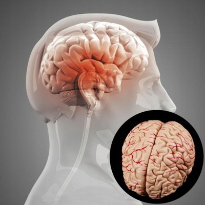 Disassembled Human Anatomical Brain Model with