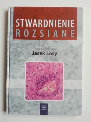 Stwardnienie rozsiane , LOSY