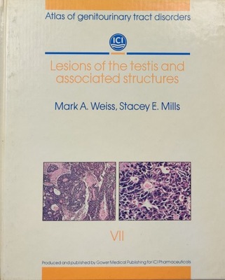 Atlas of genitourinary tract disorders Section 7 Lesions of the testis and