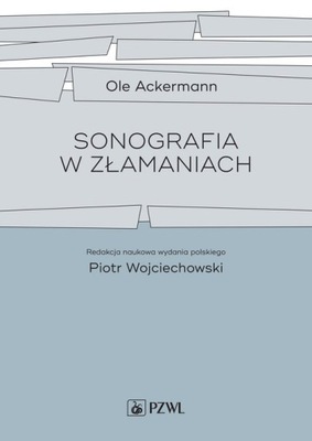 Sonografia w złamaniach