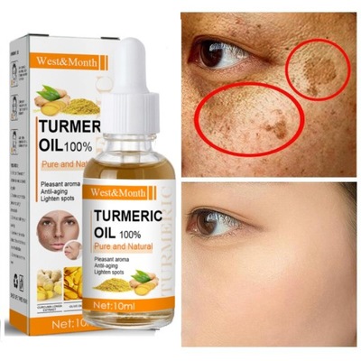Whitening Freckle Serum Brightens Anti-aging