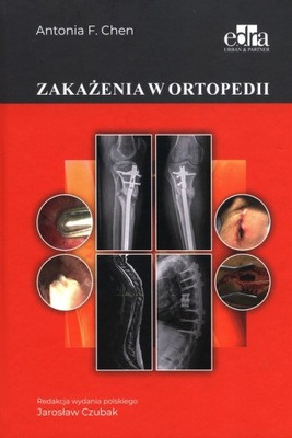 Zakażenia w ortopedii A.F. Chen