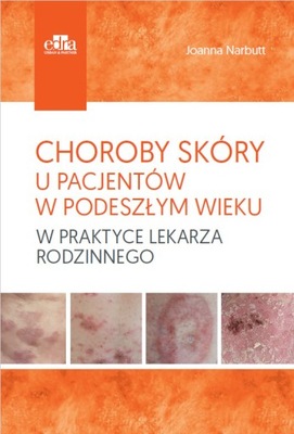 Choroby skóry u pacjentów w podeszłym wieku w praktyce lekarza rodzinnego