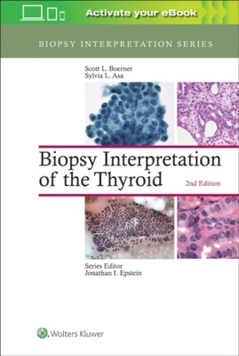 Biopsy Interpretation of the Thyroid Boerner