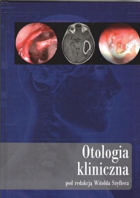 OTOLOGIA KLINICZNA, WITOLDA SZYFTERA