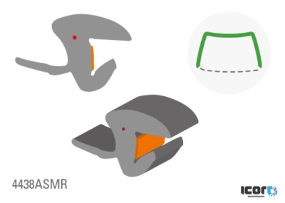 Прокладка do kia sportage iii 10- прокладка лобове фото №1