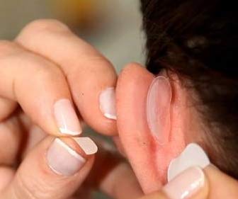 Otostick Aesthetic Ear Correctors + 2 БЕСПЛАТНО 12 зл.