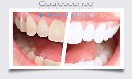 OPALESCENCE PF 2* ГЕЛЬ ДЛЯ БЕЛЕНИЯ ЗУБОВ 16%__США
