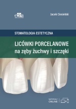 Фарфоровые виниры на зубы нижней челюсти и верхней челюсти.