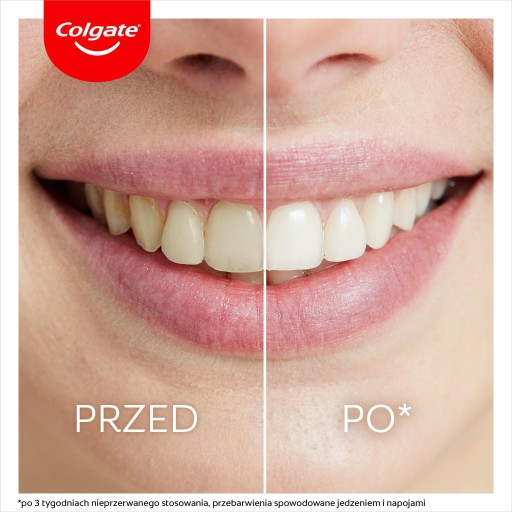 Colgate Max White Ночной отбеливающий аппликатор 2,5 мл