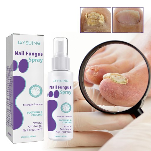 JAYSUING Nail Fungus 100 мл осветляющий спрей от грибка ногтей