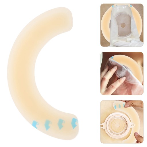 Клей для ухода за стомой Лента-кольцо Stoma 10 шт.