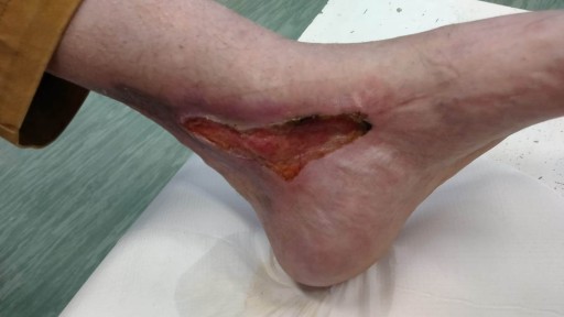 Благотворительный кирпич спасает ногу от ампутации Пожертвование1,5% от вашего налога Pit
