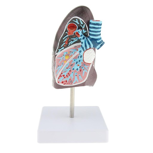 Изменения в легких органов дыхания 2:3 Lifesize M