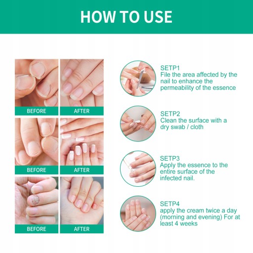 OUHOE Nail Repair Essence Nail