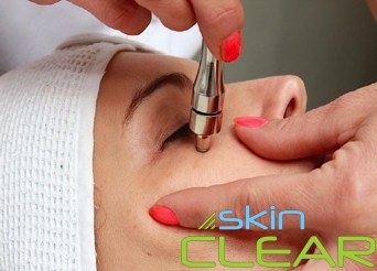SKINCLEAR АЛМАЗНАЯ МИКРОДЕРМАБРАЗИЯ МОЩНОСТЬ 110 Вт
