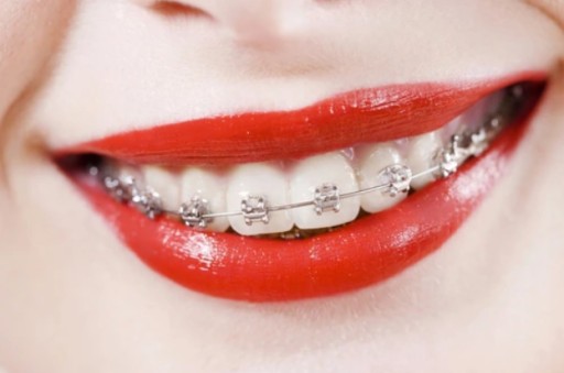 Зубная щетка Curaprox CS 5460 ORTHO 1 шт.