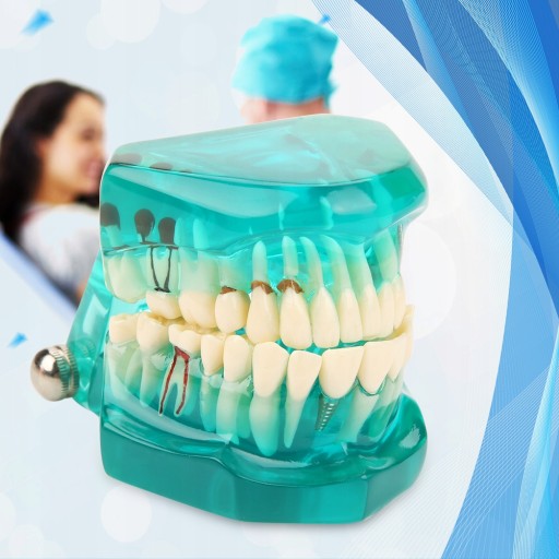 MODEL STOMATOLOGICZNY SZCZĘKA ZĘBY ZĘBOW IMPLANTY EDUKACYJNY ZĘBOWY