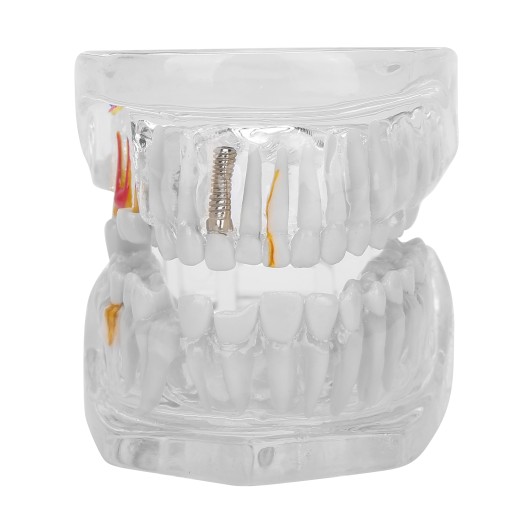 MODEL ZĘBÓW DENTYSTYCZNYCH DLA DOROSŁYCH