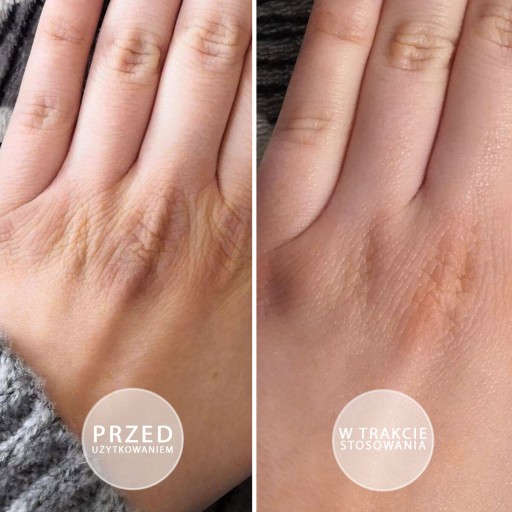 BEAUTICA увлажняющая SOS мазь для рук с витамином Е для сухой кожи 15мл