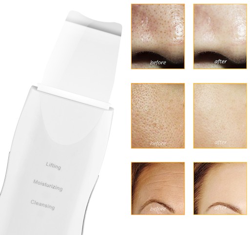 PEELING KAWITACYJNY BEZPRZEWODOWY KAWITACJA PILING TWARZY + NAKŁADKI AG207F