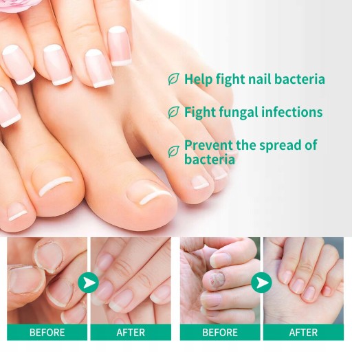 OUHOE Nail Repair Essence Nail