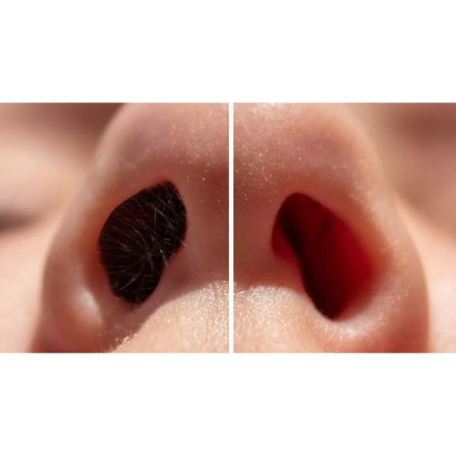ЭФФЕКТИВНЫЙ ВОСК ДЛЯ ДЕПИЛЯЦИИ НОСА Liddy Nose